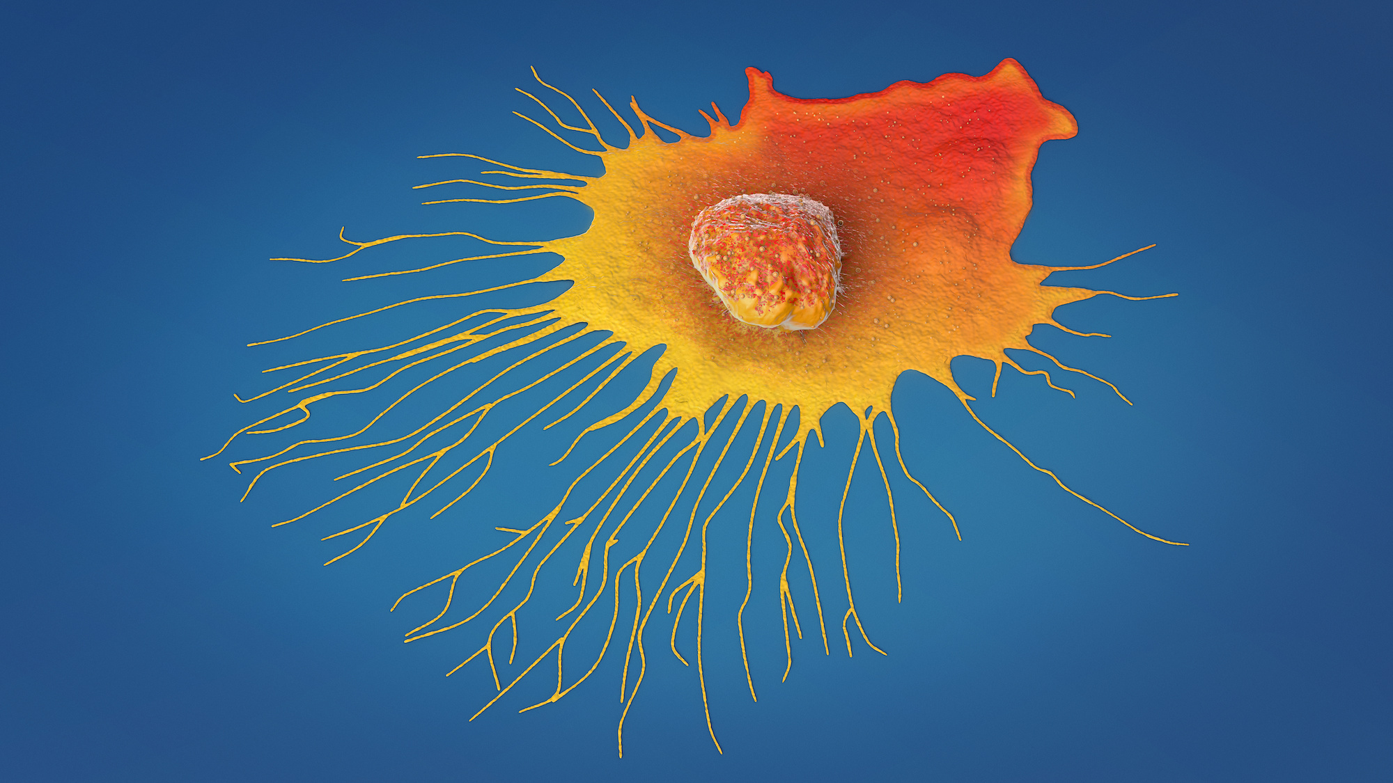 Les cancers les plus fréquents et les plus mortels en France. © Christoph Burgstedt, Adobe Stock